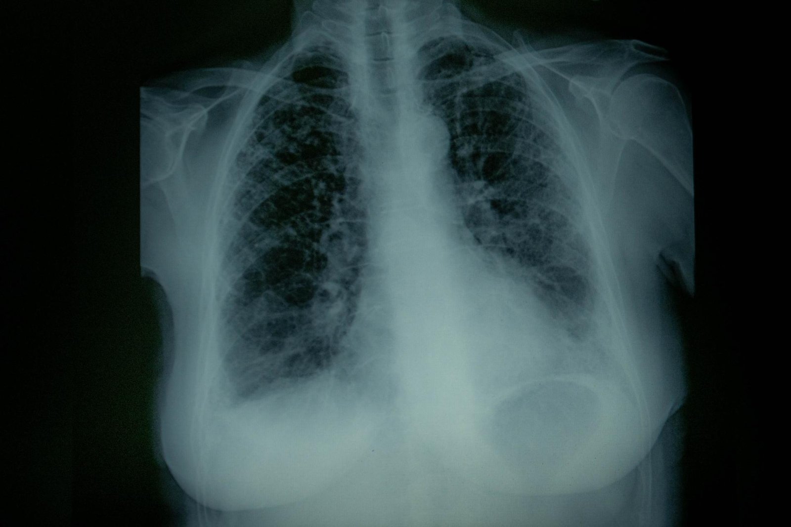 European Photography Awards Winner - Long Shadow